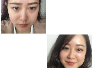  feedback trị mụn sau khi sử dụng sản phẩm Dr.Mai tại hệ thống https://drmaichinhhang.vn/