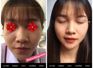  feedback trị mụn sau khi sử dụng sản phẩm Dr.Mai tại hệ thống https://drmaichinhhang.vn/