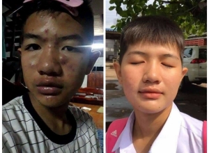  feedback trị mụn sau khi sử dụng sản phẩm Dr.Mai tại hệ thống https://drmaichinhhang.vn/