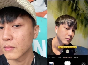  feedback trị mụn sau khi sử dụng sản phẩm Dr.Mai tại hệ thống https://drmaichinhhang.vn/